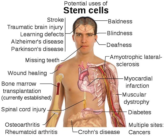 stem-cell-treatments2.jpg
